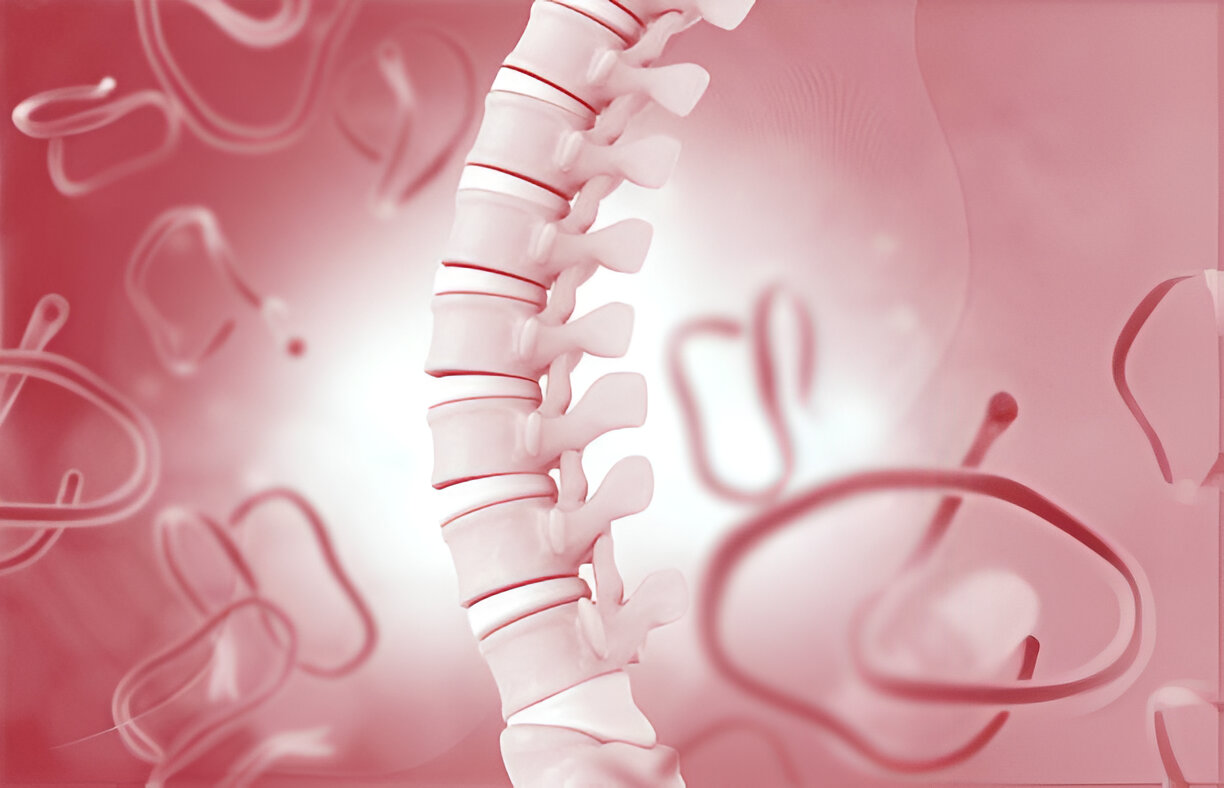 Spinal Fractures