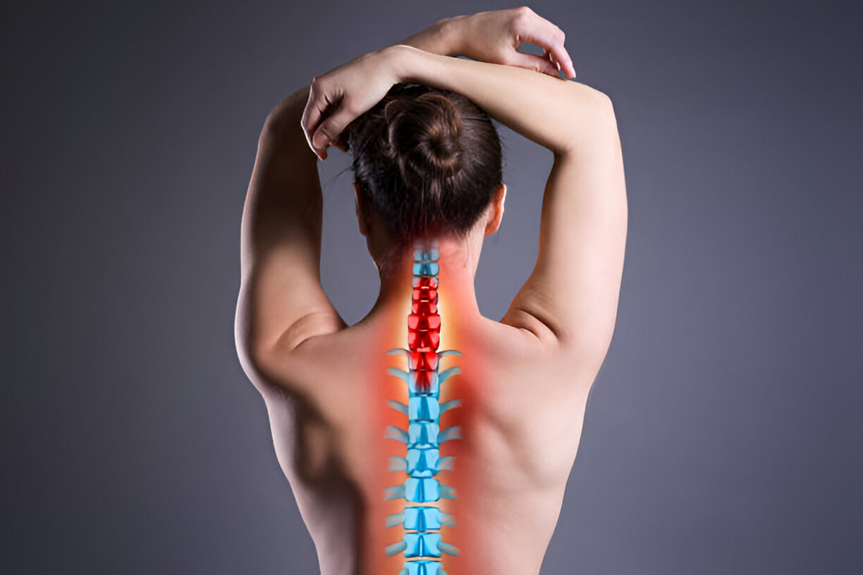 Osteoporotic Spine Fractures