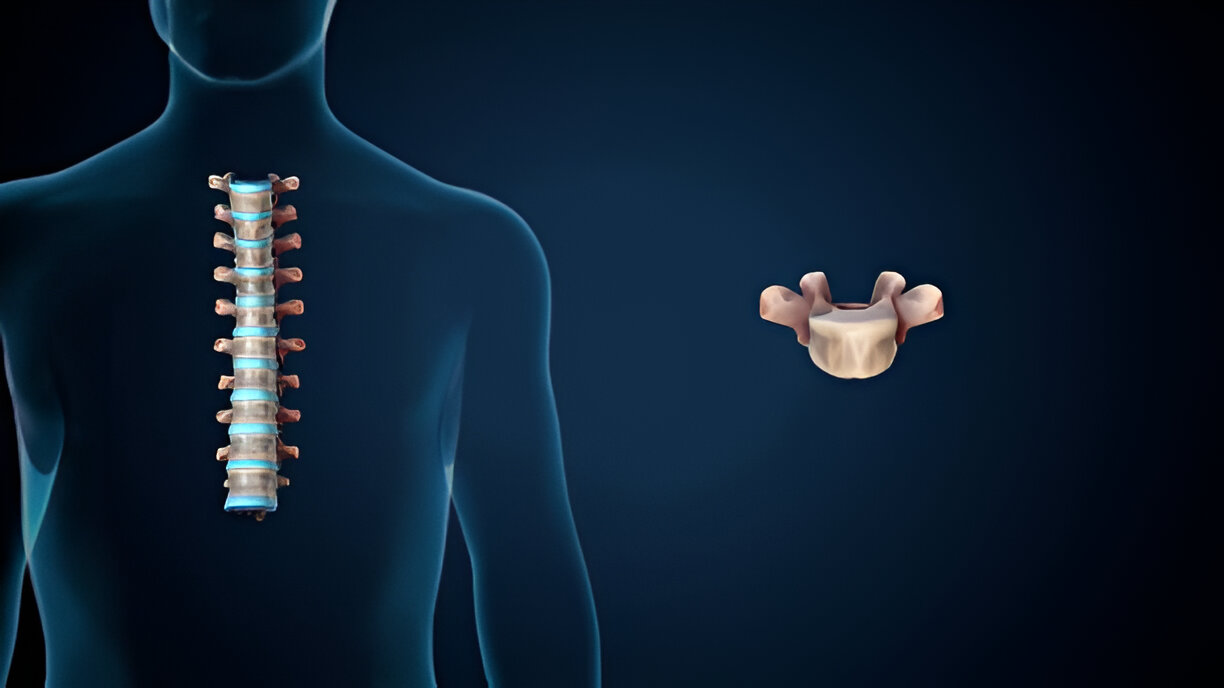 Kyphoplasty / Vertebroplasty