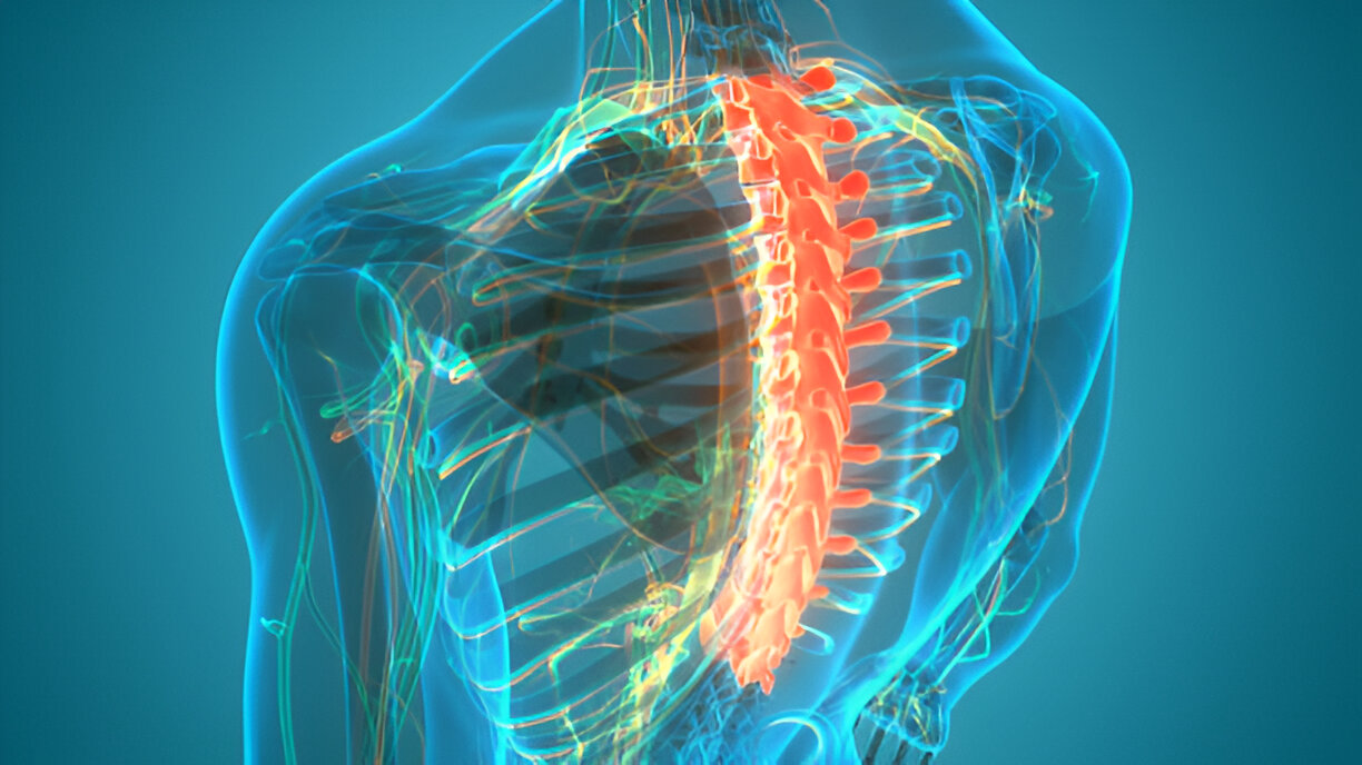 Thoracic Spine Myelopathy