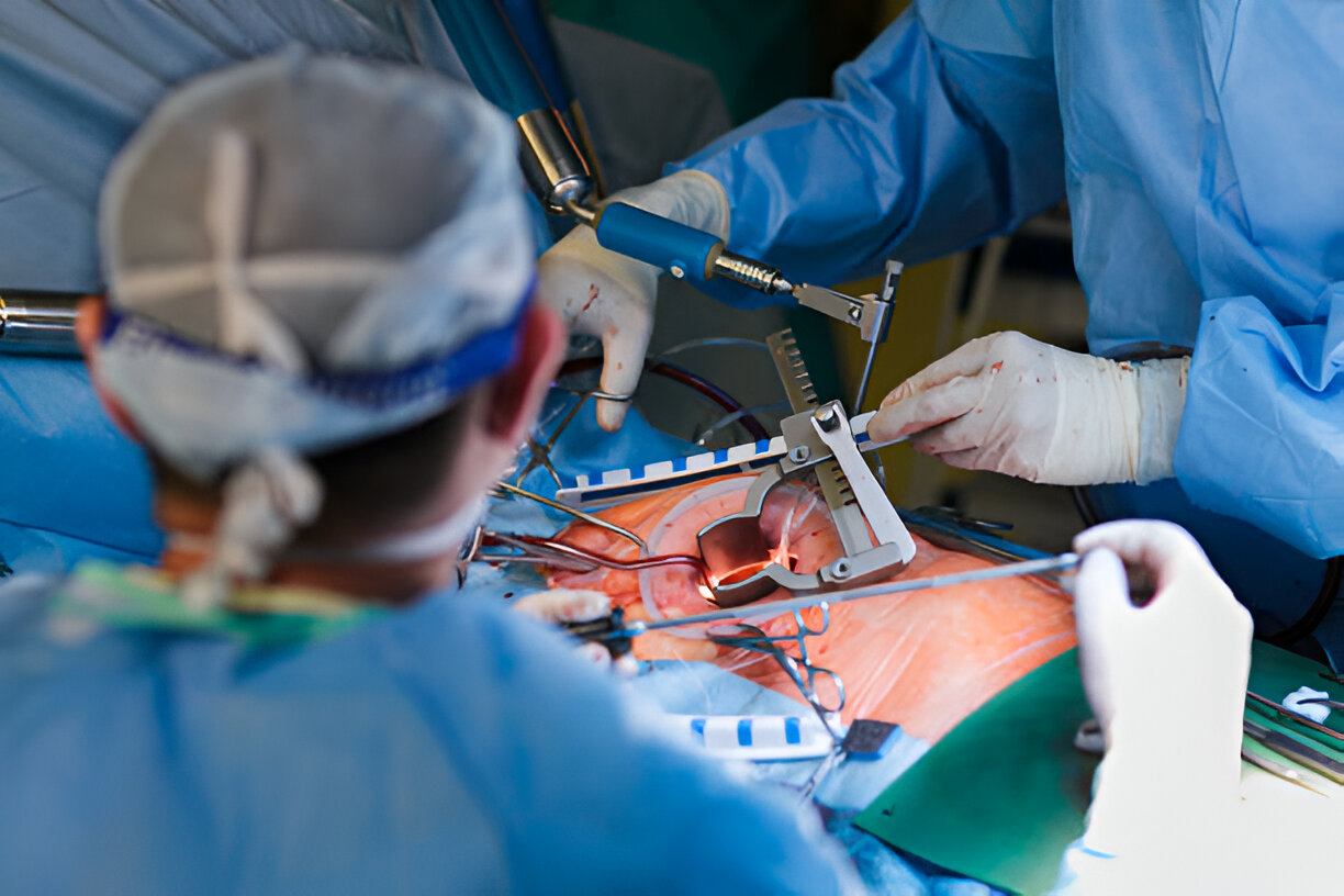 TIF Fusion Surgery