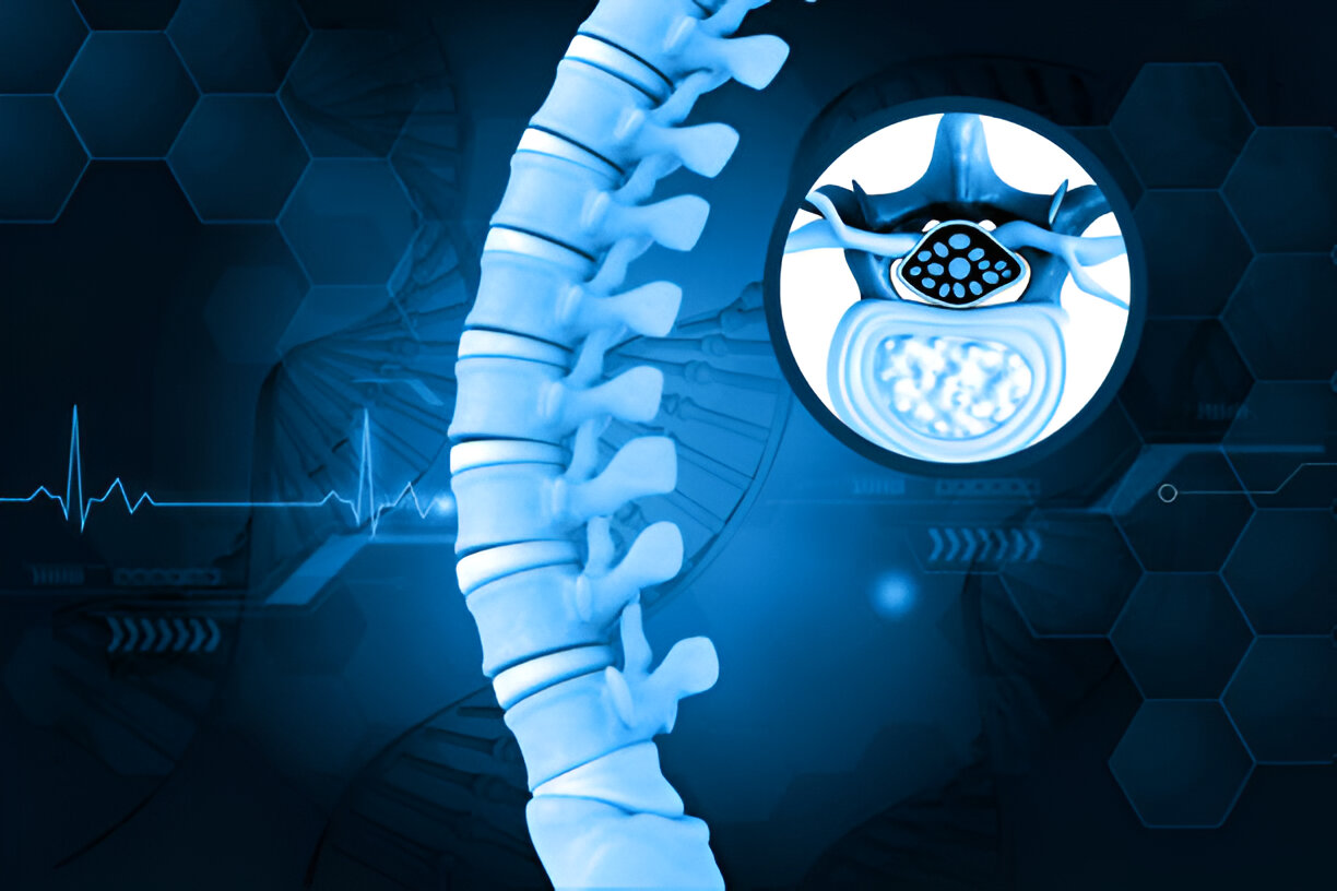 Biportal Endoscopic Spine Surgery (UBE)