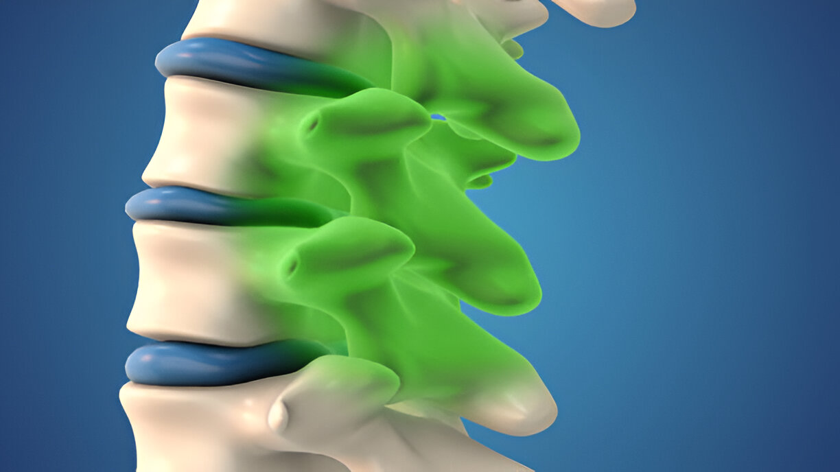 Spine Infections